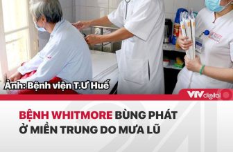 [☕️🇻🇳] NOC Coffee – Cafe bóng đá, cho thuê địa điểm offine, sinh nhật, sự kiện 🥤 Top1Coffee ☕️ Ngày 17.11, Bệnh viện T.Ư Huế phát đi cảnh báo về sự gia tăng đột biến của bệnh Whitmore do một loại vi khuẩn nguy hiểm được ghi , shares-0✔️ , likes-1❤️️ , date-2020-11-19 04:23:00🇻🇳🇻🇳🇻🇳📰🆕