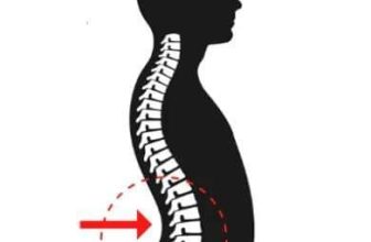 [🆕🇻🇳] YOGA NHÀ CHUNG – Giải pháp chăm sóc sức khỏe chủ động 🧘 Top1Yoga 🧘 Võng lưng, còn được gọi là tật ưỡn cột sống thắt lưng, đây là một dạng cong vẹo cột sống thường gặp ở mọi độ tuổi. Điều này không chỉ làm dáng người xấu đi , shares-0✔️ , likes-5❤️️ , date-2024-04-29 07:34:43🇻🇳🇻🇳🇻🇳📰🆕