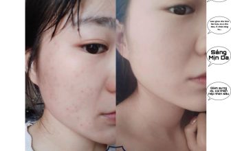 [🆕🇻🇳] Mập Style – Váy Đầm Bigsize dành cho người mập dự tiệc, đi chơi 👕 Top1Fashion 👗  “Sắc đẹp tự nó đủ sức thuyết phục đôi mắt của người khác mà chẳng cần nhà hùng biện.”
Chọn Beauty Spa DK CLARA -Yêu da đúng cách – Chọn Paula’s Choice, , shares-0✔️ , likes-1❤️️ , date-2023-03-28 12:40:42🇻🇳🇻🇳🇻🇳📰🆕