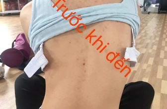 [🆕🇻🇳] Yoga Hoàng Anh – Học Viện Sống Khỏe 🧘 Top1Yoga 🧘 Đây là trường hợp bệnh lý về cột sống!
nghe em nói ” BS từ vấn mổ gấp để chỉnh lại cột sống, không sẽ khó thở “, Ba lo và khóc … cô ạh, Ba em quyết định  , shares-2✔️ , likes-9❤️️ , date-2021-06-04 02:33:37🇻🇳🇻🇳🇻🇳📰🆕