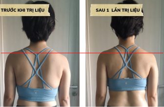 [🆕🇻🇳] YOGA NHÀ CHUNG – Giải pháp chăm sóc sức khỏe chủ động 🧘 Top1Yoga 🧘 TRỊ LIỆU ĐAU VAI GÁYThường xuyên làm việc trên máy vi tính khiến vai cổ gáy của bạn lúc nào cũng bị căng thẳng, có những hôm đau không ngủ được, cả đêm t , shares-0✔️ , likes-1❤️️ , date-2022-08-10 18:19:36🇻🇳🇻🇳🇻🇳📰🆕