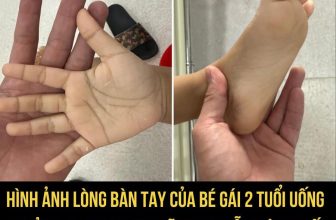 [🆕🇻🇳] Hi, embe –  Cửa hàng quần áo sơ sinh & trẻ em – Say “Hi” & Be a happy child with us :) 🧑‍🧒❤️️👶⭐️ Nhìn lòng bàn tay của bé gái 2 tuổi uống khoảng 2000-2500 ml sữa tươi mỗi ngày khiến nhiều người x.ót xaTheo bác sĩ Nguyễn Thanh Sang (Bệnh viện Nhi Đồn , shares-0✔️ , likes-11❤️️ , date-2024-05-07 01:30:07🇻🇳🇻🇳🇻🇳📰🆕