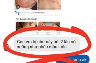 [🆕🇻🇳] Vũ Nga / Chuyên sỉ lẻ đồ sơ sinh – Quần áo trẻ em 🧑‍🧒❤️️👶⭐️ hăm ngứa ,Ronna ,chàm sữa mẩn đỏ muỗi đốt gặp e cái là hết liền nha
Em thuốc hăm ngứa thần thánh dùng là nghiền nha
Cam kết là hết liền
, shares-0✔️ , likes-3❤️️ , date-2024-09-04 01:32:55🇻🇳🇻🇳🇻🇳📰🆕