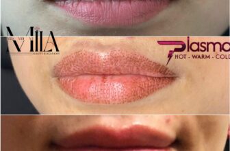 [???] MiLa Beauty & Academy ?? Top1Makeup ??  Quá nhiều kiến thức hay và bổ ích về Plasma thêm vào cẩm nang làm đẹp an toàn cho chị em tụi mình rồi đâyTrước khi học em vẫn hoài nghi về Plasma lắm. Sa , shares-0✔️ , likes-0❤️️ , date-2024-09-08 18:35:14????????