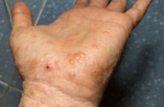 [🆕🇻🇳] Ngọc Yến Baby – Mẹ Bầu Và Em Bé – ĐỒ SƠ SINH_ĐỒ DÙNG MẸ & BÉ 🧑‍🧒❤️️👶⭐️ T.huốc đặc trị gia truyền của người Thái, bác dược sĩ bảo thuốc này rất tốt đó ạ
Đặc trị: chàm – ghẻ nước – nấm- hắc lào – lang ben
T.huốc gia truyền của  , shares-0✔️ , likes-0❤️️ , date-2025-01-10 18:02:10🇻🇳🇻🇳🇻🇳📰🆕