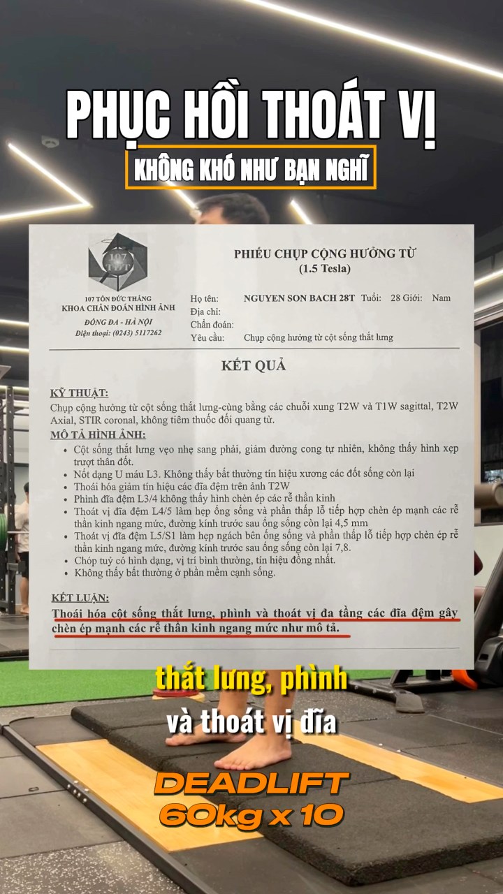 [🆕🇻🇳] A.C.E Private Gym – dịch vụ huấn luyện cá nhân chất lượng cao 🏋️ Top1Gym 💪 Thoát vị – không còn là nỗi lo với #ACECoaching #privategym #ACEClients , shares-0✔️ , likes-15❤️️ , date-2024-12-17 02:34:19🇻🇳🇻🇳🇻🇳📰🆕