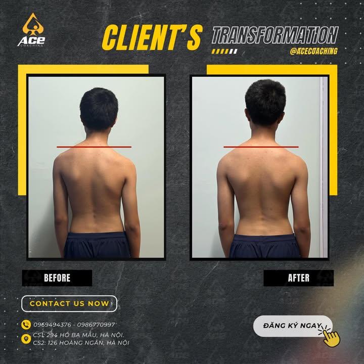 [💪🇻🇳] A.C.E Private Gym – dịch vụ huấn luyện cá nhân chất lượng cao 🏋️ Top1Gym 💪 – Cong vẹo cột sống có thể chỉnh được qua tập luyện không? Hãy để bức ảnh …