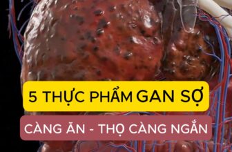 [🆕🇻🇳] Ruby Yoga Và Dance 🧘 Top1Yoga 🤸🏻‍♀️ Nếu mệt mỏi, bệnh tật & béo phì, gan đang cầu cứu bạn #gannhiemmo #xogan #ungthugan #ungthu #leconghiep , shares-0✔️ , likes-0❤️️ , date-2025-02-19 02:31:32🇻🇳🇻🇳🇻🇳📰🆕