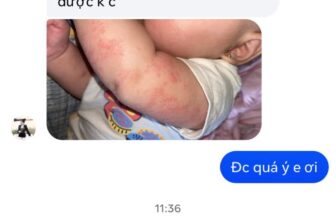 [🆕🇻🇳] Vũ Nga / Chuyên sỉ lẻ đồ sơ sinh – Quần áo trẻ em 🧑‍🧒❤️️👶⭐️ Hăm ,ngứa,tràm sữa,mẩn đỏ nhà e Nga đây đỉnh k ạ
Dùng là khỏi nha k khỏi k lấy điên
, shares-0✔️ , likes-5❤️️ , date-2025-03-06 19:11:40🇻🇳🇻🇳🇻🇳📰🆕