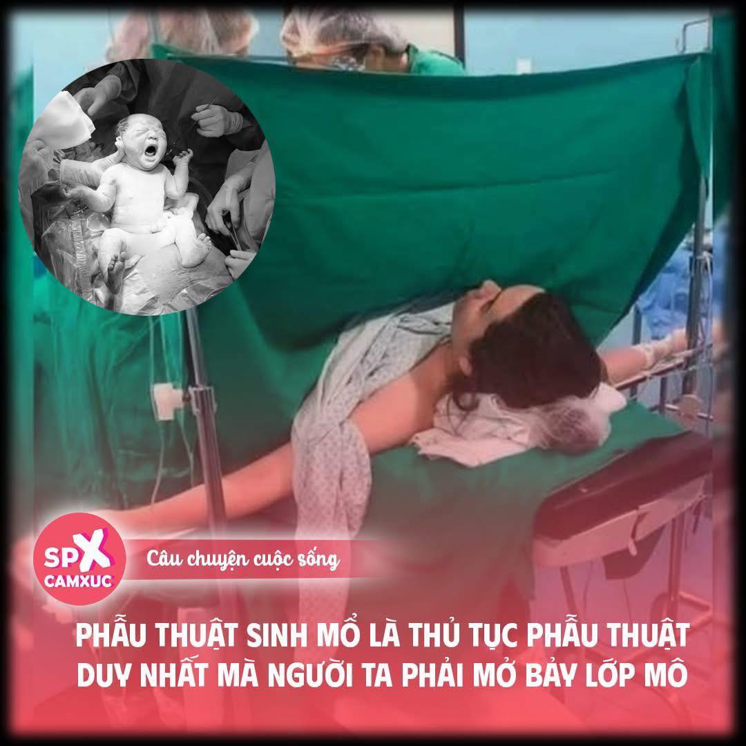 [🆕🇻🇳] Tiệm nhà Min – Shop chuyên quần áo trẻ em hàng QCCC, phong cách Hàn Quốc 😎❤️️⭐️ Phẫu thuật sinh mổ là thủ tục phẫu thuật duy nhất mà người ta phải mở bảy lớp mô:  Da, mô dưới da, màng bọc cơ, cơ thẳng bụng, màng bụng, tử cung và túi ối , shares-3✔️ , likes-6❤️️ , date-2025-03-09 03:39:27🇻🇳🇻🇳🇻🇳📰🆕