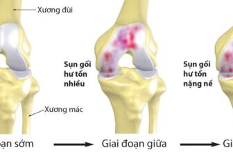 [🆕🇻🇳] Ruby Yoga Và Dance 🧘 Top1Yoga 🤸🏻‍♀️ Thói quen bảo vệ khớp gốiKhớp gối là bộ phận quan trọng giúp nâng đỡ cơ thể và thực hiện các hoạt động như đi lại, chạy nhảy, ngồi xổm… Nếu không chăm só , shares-0✔️ , likes-0❤️️ , date-2025-03-12 04:58:12🇻🇳🇻🇳🇻🇳📰🆕