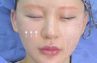 [🆕🇻🇳] Quàng Châu Order – CHUYÊN HÀNG QUẢNG CHÂU 👕 Top1Fashion 👗  Phương pháp căng da smas hay còn gọi là nâng cơ táo. KHÔNG PHẪU THUẬT. Hiệu quả dài lâu. Chỉ vài chục trịu , shares-0✔️ , likes-0❤️️ , date-2025-03-17 07:40:40🇻🇳🇻🇳🇻🇳📰🆕