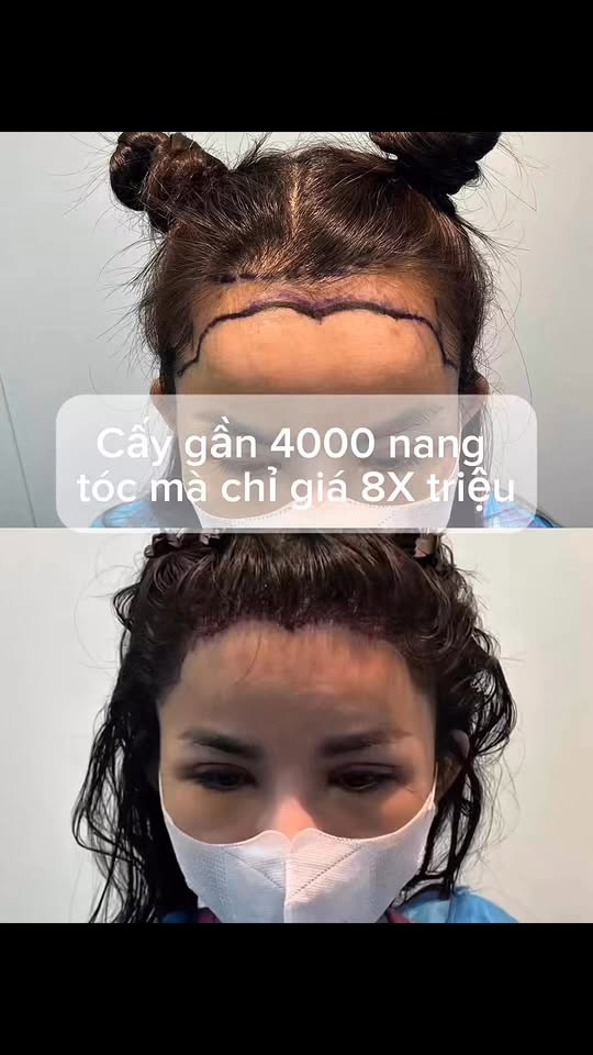 [🆕🇻🇳] Quàng Châu Order – CHUYÊN HÀNG QUẢNG CHÂU 👕 Top1Fashion 👗  Cấy 5000 hay 6000 nang đi nữa nhà em cũng chỉ 8X trẹo , shares-0✔️ , likes-0❤️️ , date-2025-06-14 03:37:44🇻🇳🇻🇳🇻🇳📰🆕