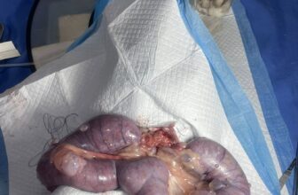 [🆕🇻🇳] Phòng khám Thú y NAN PET  🐶🦜 Top1Pets 🐱🐠 Phẫu thuật viêm tửcung cho bà corgi
Nanpet 195 Ngô Xuân Quảng
0335 997 338
, shares-0✔️ , likes-4❤️️ , date-2025-06-03 17:58:53🐶🐱🇻🇳🇻🇳🇻🇳📰🆕