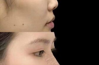 [🆕🇻🇳] Quàng Châu Order – CHUYÊN HÀNG QUẢNG CHÂU 👕 Top1Fashion 👗  Mũi sụn sườn Thượng Hải chỉ có giá 12x triệu. Một con số thật sự bất ngờ với những tín đồ làm đẹp như em. Bởi thật sự với một chiếc mũi hoàn hảo như này củ , shares-0✔️ , likes-0❤️️ , date-2025-06-21 04:48:55🇻🇳🇻🇳🇻🇳📰🆕