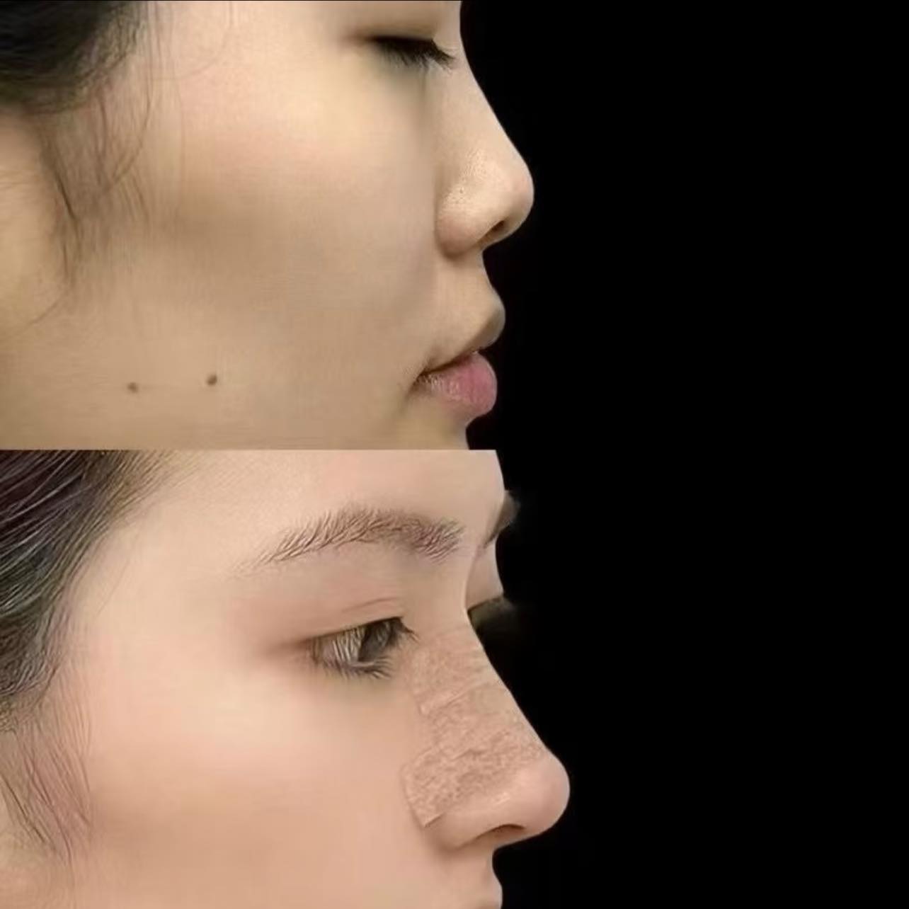 [🆕🇻🇳] Quàng Châu Order – CHUYÊN HÀNG QUẢNG CHÂU 👕 Top1Fashion 👗  Mũi sụn sườn Thượng Hải chỉ có giá 12x triệu. Một con số thật sự bất ngờ với những tín đồ làm đẹp như em. Bởi thật sự với một chiếc mũi hoàn hảo như này củ , shares-0✔️ , likes-0❤️️ , date-2025-06-21 04:48:55🇻🇳🇻🇳🇻🇳📰🆕