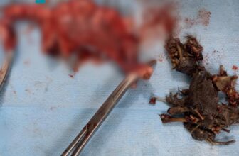 [🆕🇻🇳] Phòng khám Thú y Đồng Hành Cần Thơ 🐶🦜 Top1Pets 🐱🐠 CASE REPORT: U QUÁI TỬ CUNG – BUỒNG TRỨNG TRÊN MÈOBé mèo được đưa đến khám trong tình trạng chảy dịch âm đạo, sốt cao, sút cân, bỏ ăn. Qua siêu âm, BSTY , shares-0✔️ , likes-13❤️️ , date-2025-08-01 22:06:24🐶🐱🇻🇳🇻🇳🇻🇳📰🆕