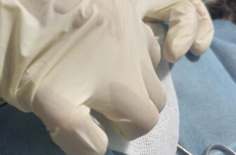 [🆕🇻🇳] Bệnh Viện Thú Y Tây Bắc 🐶🦜 Top1Pets 🐱🐠 Lấy dị vật tiêu hoá cho em bé mèo 3 tháng tuổi háu ăn. Bé ăn cả hạt ô mai làm tắc ruột luôn.Bệnh viện thú y Tây Bắc
Đc: 832, đường Yên Ninh, Phường Yên , shares-0✔️ , likes-0❤️️ , date-2025-08-19 15:23:58🐶🐱🇻🇳🇻🇳🇻🇳📰🆕