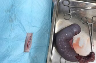 [🆕🇻🇳] Rainiz – Siêu Thị Thú Cưng 🐶🦜 Top1Pets 🐱🐠 CA MỔ VIÊM TỬ CUNG HOÀN THÀNHSau khi được tiêm thuốc ngừa thai hơn 1 tháng trước, bé Đen có dấu hiệu bụng to, chảy dịch nâu hôi và sốt, bỏ ăn. Gia đình  , shares-0✔️ , likes-4❤️️ , date-2025-08-23 00:05:13🐶🐱🇻🇳🇻🇳🇻🇳📰🆕