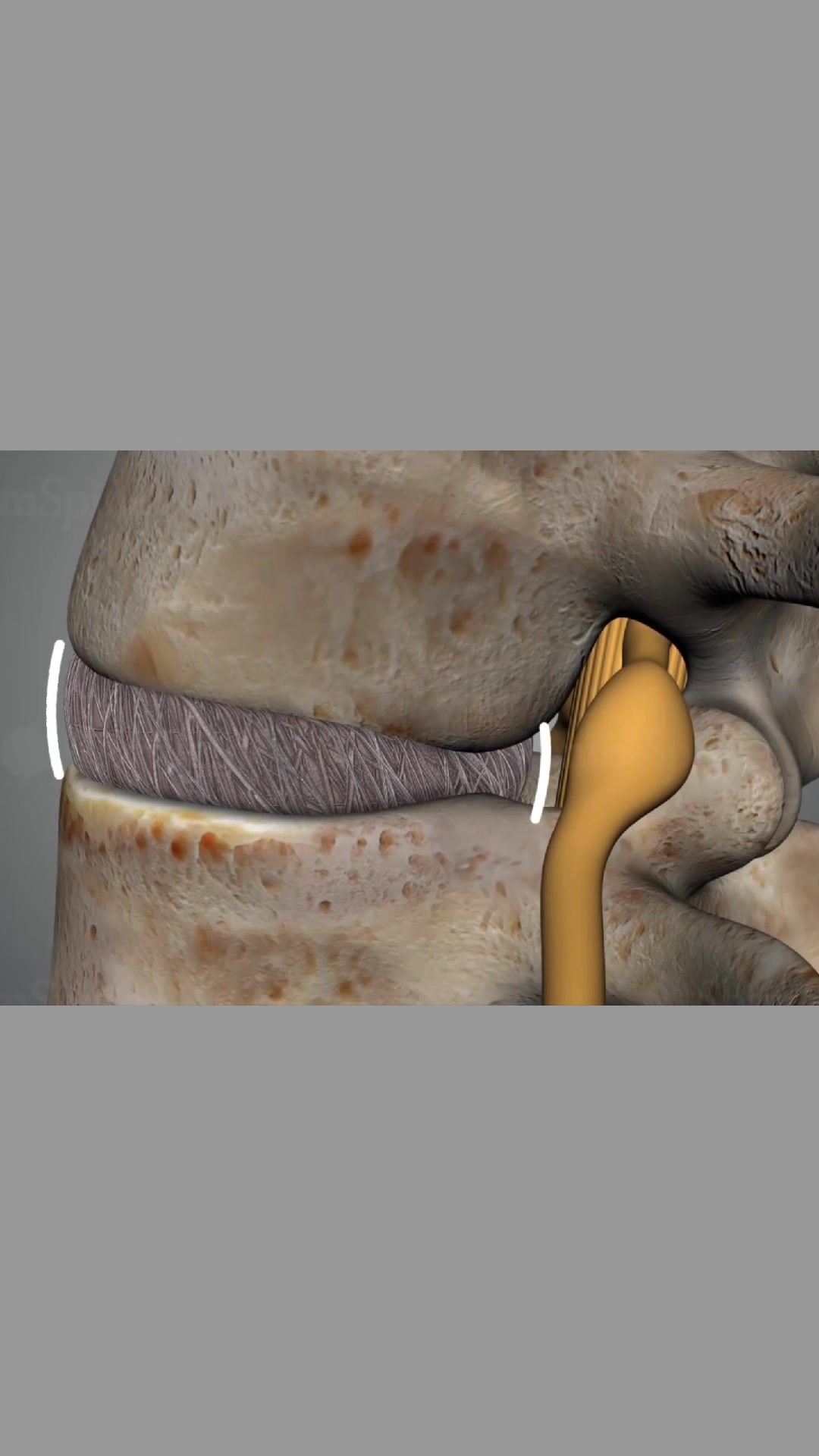 Hội Giáo Viên Yoga Giỏi Uy Tín Việt Nam 😎❤️️⭐️ Bu1ea1n bu1ecb u0111au lu01b0ng?nBu1ea1n u0111ang loay hoay mu00e0 vu1eabn chu01b0a biu1ebft nguyu00ean nhu00e2n th… , shares-0✔️ , likes-0❤️️ , date-2025-04-29 04:42:10🇻🇳🇻🇳🇻🇳📰🆕