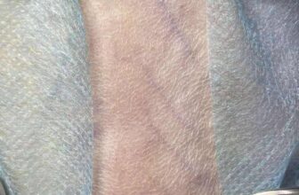 [🆕🇻🇳] Phòng khám Thú Y Hà Nam 🐶🦜 Top1Pets 🐱🐠  Triệt sản Chó Mèo uy tín tại HANAMVET
———————
Triệt Sản Chó Mèo: Vì Yêu Thương, Vì Sức Khỏe!
Triệt sản không chỉ là một thủ thuật đơn giả , shares-6✔️ , likes-5❤️️ , date-2025-06-20 18:25:05🐶🐱🇻🇳🇻🇳🇻🇳📰🆕