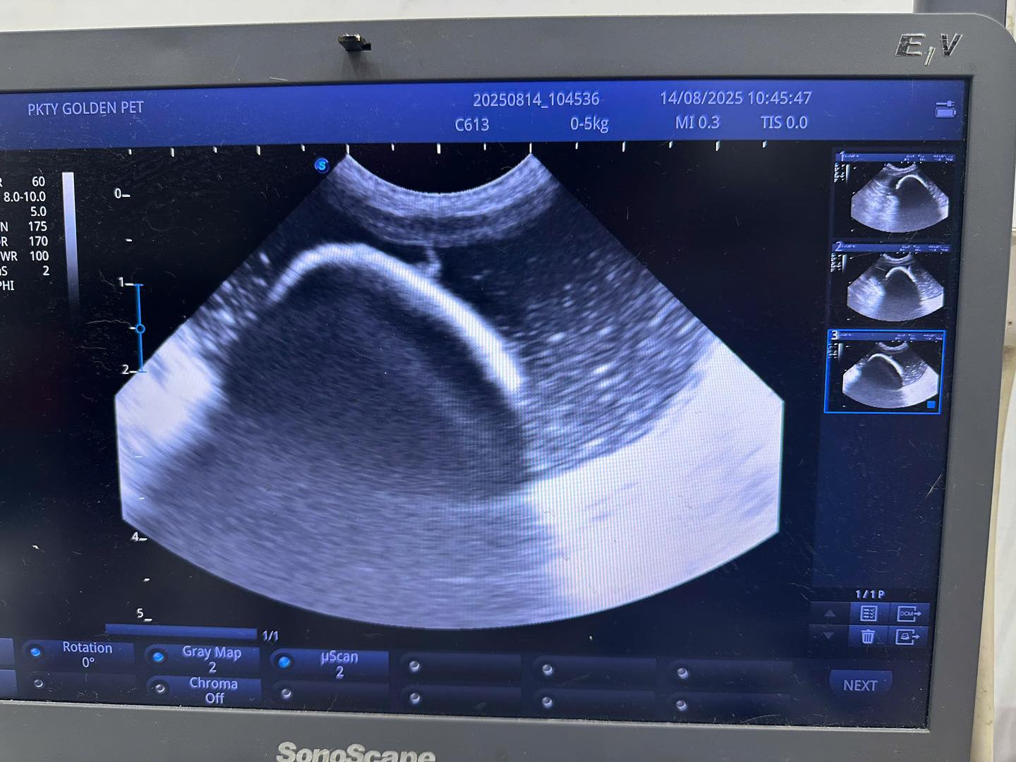 [🆕🇻🇳] Bệnh Viện Thú Y GoldenVet 🐶🦜 Top1Pets 🐱🐠 Hình ảnh sỏi trên máy siêu âm và khi đc mổ lấy ra !
————————————-
Bệnh Viện Thú Y GoldenVet.
Chuyên:
Khám, điều trị, tư vấn chó mè , shares-0✔️ , likes-5❤️️ , date-2025-08-15 03:31:52🐶🐱🇻🇳🇻🇳🇻🇳📰🆕