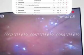 [🆕🇻🇳] Phòng Khám Thú Y Pet Plus 🐶🦜 Top1Pets 🐱🐠  BÉ MÈO TIÊU CHẢY MÃN TÍNH VÀ HÀNH TRÌNH ĐIỀU TRỊ ĐẦY THỬ THÁCHNội soi trực tràng: Viêm loét nặng
Xét nghiệm: Dương tính với Clostridium perfringens – , shares-0✔️ , likes-14❤️️ , date-2025-10-11 04:29:00🐶🐱🇻🇳🇻🇳🇻🇳📰🆕