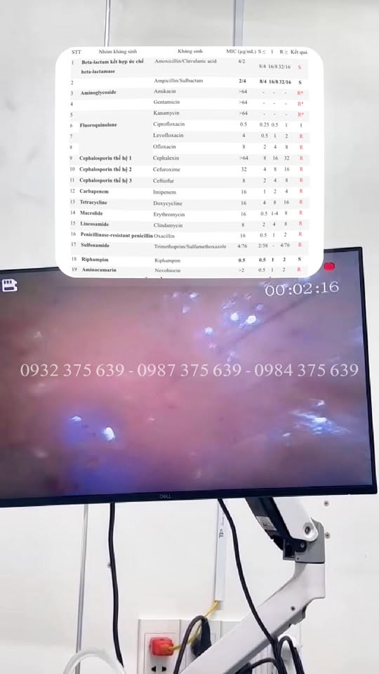 [🆕🇻🇳] Phòng Khám Thú Y Pet Plus 🐶🦜 Top1Pets 🐱🐠  BÉ MÈO TIÊU CHẢY MÃN TÍNH VÀ HÀNH TRÌNH ĐIỀU TRỊ ĐẦY THỬ THÁCHNội soi trực tràng: Viêm loét nặng
Xét nghiệm: Dương tính với Clostridium perfringens – , shares-0✔️ , likes-14❤️️ , date-2025-10-11 04:29:00🐶🐱🇻🇳🇻🇳🇻🇳📰🆕