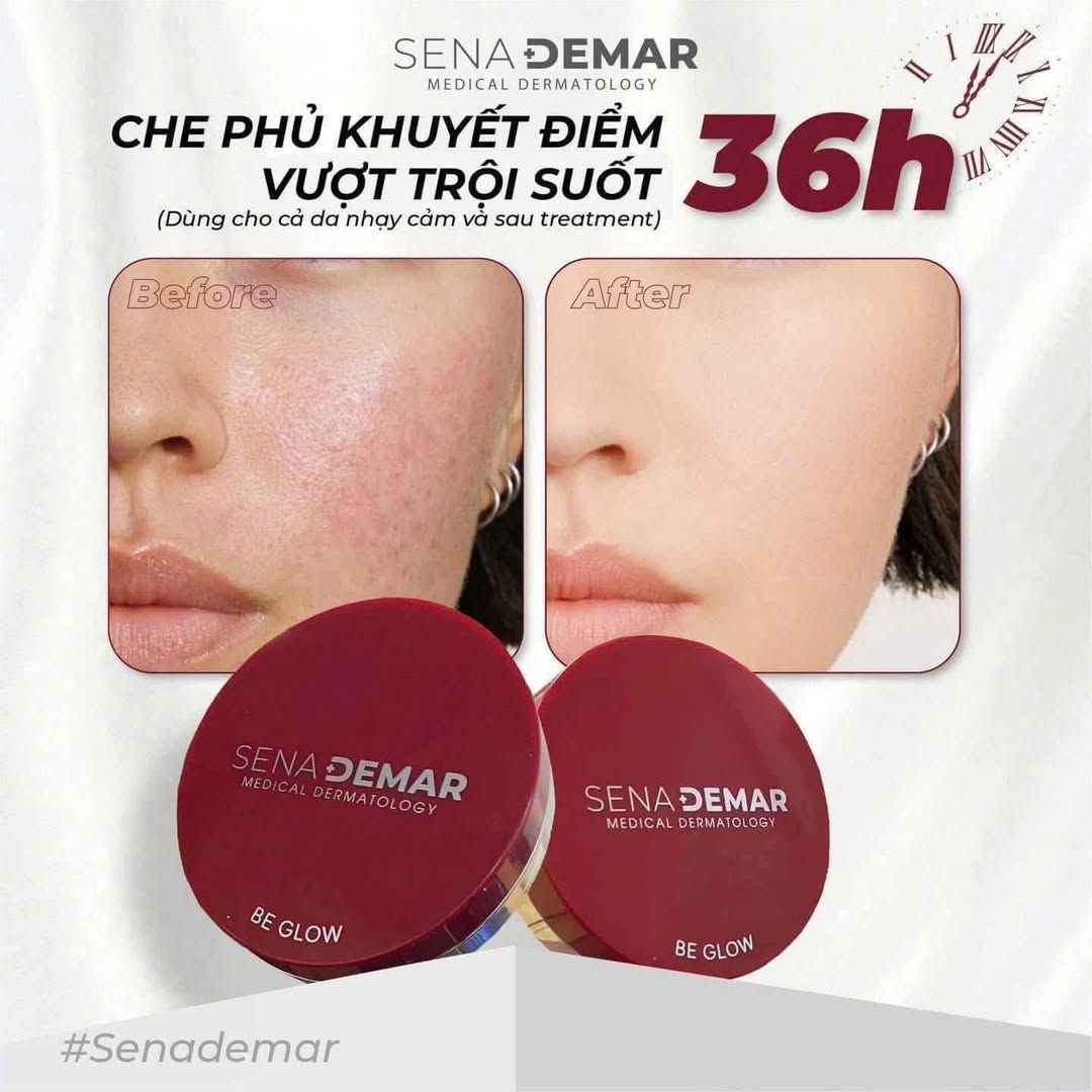 [🆕🇻🇳] Bao Anh  (Mỹ phẩm chính hãng) [🆕Top1Vietnam🇻🇳] 👕 Top1Fashion 👗  Phấn nước Senaderma, chân ái cho mấy ce yêu cầu 1 lớp nền mỏng nhẹ tự nhiên nhưng vẫn che phủ được thâm.
Vừa là kem nền siêu mướt, vừa chống nắng ngon làn , shares-0✔️ , likes-0❤️️ , date-2025-10-23 01:55:35🇻🇳🇻🇳🇻🇳📰🆕