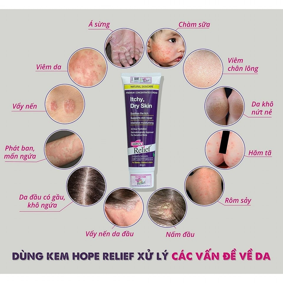 [🆕🇻🇳]  Kiokids – sản phẩm chăm sóc sức khỏe mẹ & bé chính hãng  🧑‍🧒❤️️👶⭐️ Kem đa năng Hope’s Relief 60gĐặc trị các vấn đề về da : da sần, da khô, da khô, ngứa, eczema, vảy nến, chàm…, cấp ẩm, dưỡng da cho tất cả các mùa tron , shares-0✔️ , likes-0❤️️ , date-2025-10-24 21:31:00🇻🇳🇻🇳🇻🇳📰🆕