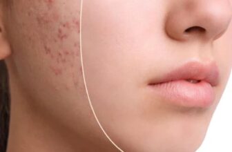 [🆕🇻🇳] ULA Namaste YOGA -Thanh Hóa 🧘 Top1Yoga 🤸🏻‍♀️ ĐIỀU TRỊ MỤN
Nhân mụn hình thành do sự tích tụ bã nhờn, tế bào chết và bụi bẩn gây bít tắc lỗ chân lông. Tùy vào nguyên nhân mà các chuyên gia da  , shares-0✔️ , likes-0❤️️ , date-2023-10-31 16:44:07🇻🇳🇻🇳🇻🇳📰🆕