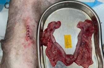 [🆕🇻🇳] Phòng Khám Thú Y Sky Pet 🐶🦜 Top1Pets 🐱🐠 Triệt sản cho bé phú quốc 13kg ạ
, shares-0✔️ , likes-1❤️️ , date-2024-11-30 18:01:52🐶🐱🇻🇳🇻🇳🇻🇳📰🆕