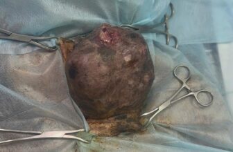 [🆕🇻🇳] Phòng khám Thú Y Vĩnh Phúc 🐶🦜 Top1Pets 🐱🐠 11 tuổi, vẫn là chiến binh dũng cảm nhất.
Hành trình loại bỏ khối u vú -vì những năm tháng an yên phía trước.
 , shares-2✔️ , likes-8❤️️ , date-2025-10-04 23:11:54🐶🐱🇻🇳🇻🇳🇻🇳📰🆕