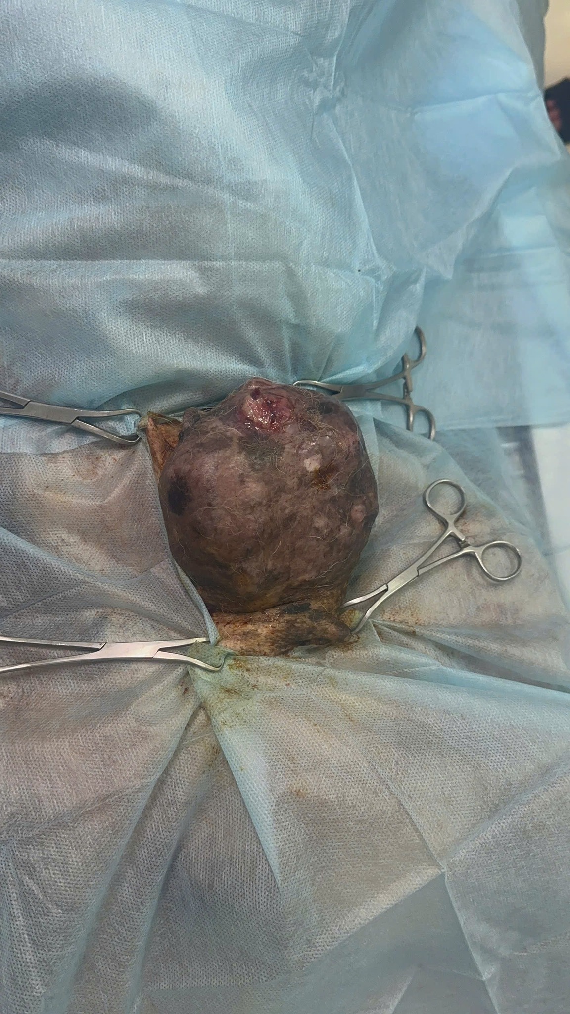 [🆕🇻🇳] Phòng khám Thú Y Vĩnh Phúc 🐶🦜 Top1Pets 🐱🐠 11 tuổi, vẫn là chiến binh dũng cảm nhất.
Hành trình loại bỏ khối u vú -vì những năm tháng an yên phía trước.
 , shares-2✔️ , likes-8❤️️ , date-2025-10-04 23:11:54🐶🐱🇻🇳🇻🇳🇻🇳📰🆕