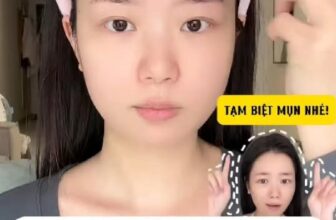 [🆕🇻🇳] SXM Clothes 👕 Top1Fashion 👗  Lưu ý vị trí bị mọc mụn ở những nơi sau nha #TBGaff #bloglamdep #body #tiplamdep #reels #genz #viral #trangdiem #skincare , shares-0✔️ , likes-0❤️️ , date-2025-12-01 20:32:07🇻🇳🇻🇳🇻🇳📰🆕