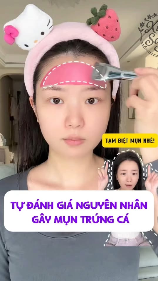 [🆕🇻🇳] SXM Clothes 👕 Top1Fashion 👗  Lưu ý vị trí bị mọc mụn ở những nơi sau nha #TBGaff #bloglamdep #body #tiplamdep #reels #genz #viral #trangdiem #skincare , shares-0✔️ , likes-0❤️️ , date-2025-12-01 20:32:07🇻🇳🇻🇳🇻🇳📰🆕