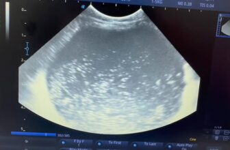 [🆕🇻🇳] Phòng khám Thú Y – Spa Nguyên An Bình 🐶🦜 Top1Pets 🐱🐠 Tiếp tục xử lý 1 ca Sỏi Bàng Quang – Sỏi Tiết Niệu
Trên cá thể mèo đực – 2 tuổi
Với chế độ ăn toàn hạt mà ít nước
Bé bí tiểu 1 tuần rồi mới đưa đi khám , shares-0✔️ , likes-2❤️️ , date-2025-12-04 20:49:58🐶🐱🇻🇳🇻🇳🇻🇳📰🆕