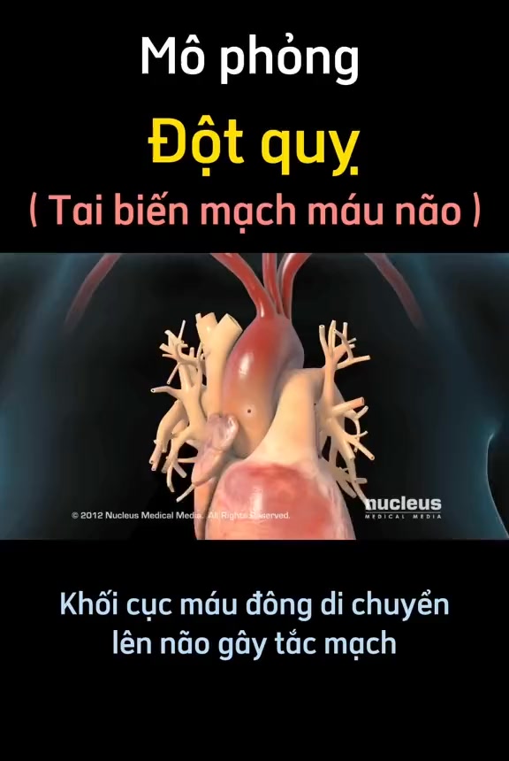 [🆕🇻🇳] Tambooks Yoga  – Học viện Yoga Online Tambooks Việt Nam 🧘 Top1Yoga 🤸🏻‍♀️ Mô phỏng đột quỵ (tai biến mạch máu não)
 #dotquy #suckhoe #reels #healthyfood , shares-0✔️ , likes-11❤️️ , date-2025-12-19 03:34:08🇻🇳🇻🇳🇻🇳📰🆕