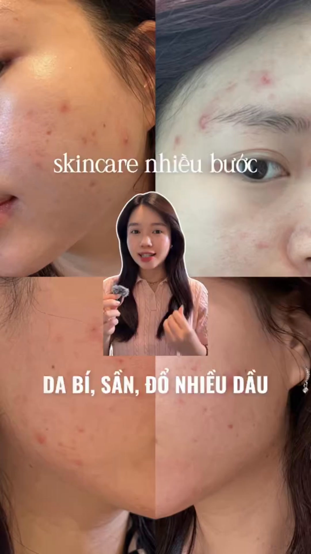 [🆕🇻🇳] Chella Việt Nam – Sức khỏe – Sắc đẹp [🆕Top1Vietnam🇻🇳]  💅💇 Top1Makeup 💕👄  ud83dudea8Cu1ea2NH Bu00c1O: u0110u1eebng xem video nu00e0y nu1ebfu khu00f4ng muu1ed1n tu1ed1n tiu1ec1n! ud83dudeabud83dudcb8nnu2728 u1e